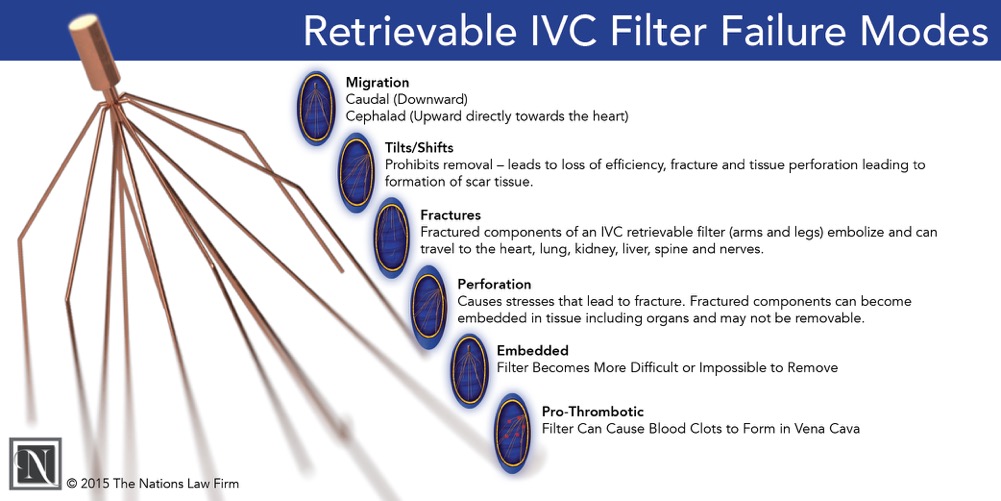 Ivc Filters The Nations Law Firm